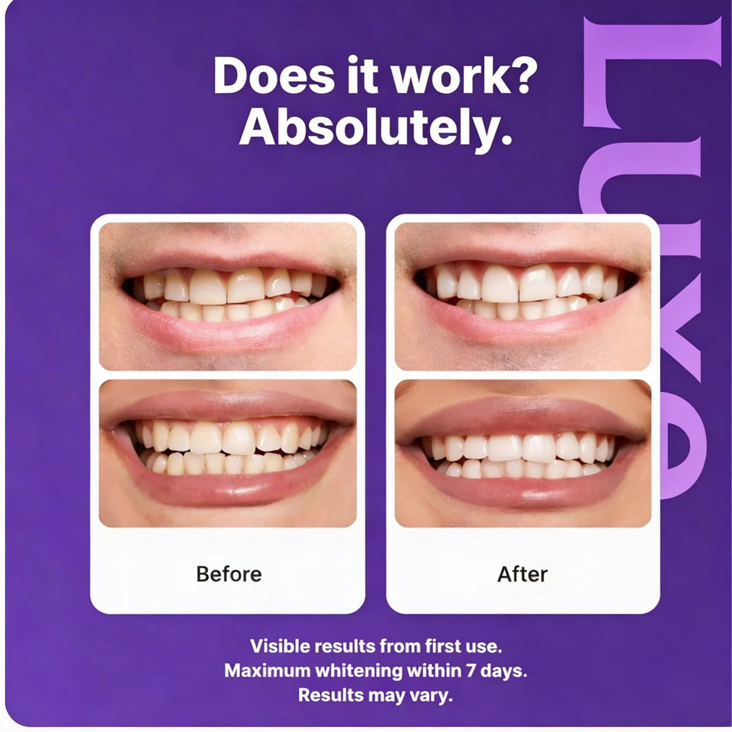 Luxe Purple Daily BrightSmile Whitening Strips Kit