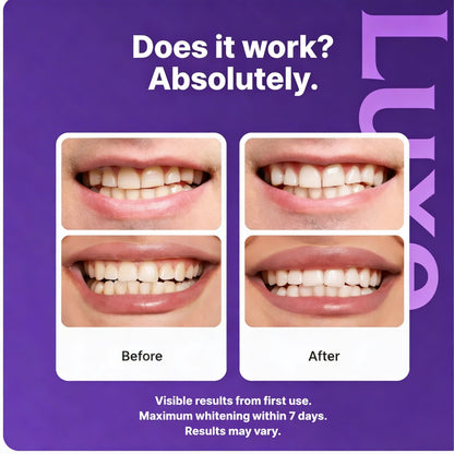 Luxe Purple Daily BrightSmile Whitening Strips Kit