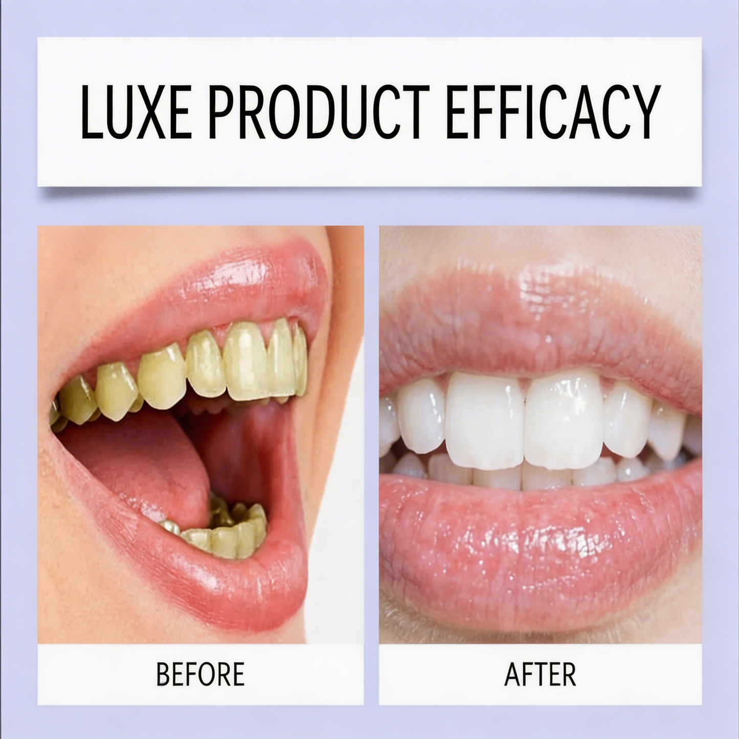 Luxe Purple Daily BrightSmile Whitening Strips Kit