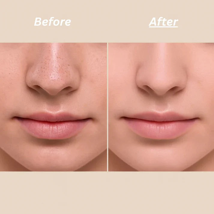 Peel Shot Glow Rice Ampoule