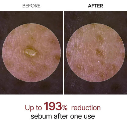 Dr. Melaxin Peel Shot Ampoule – Radiance in a Bottle